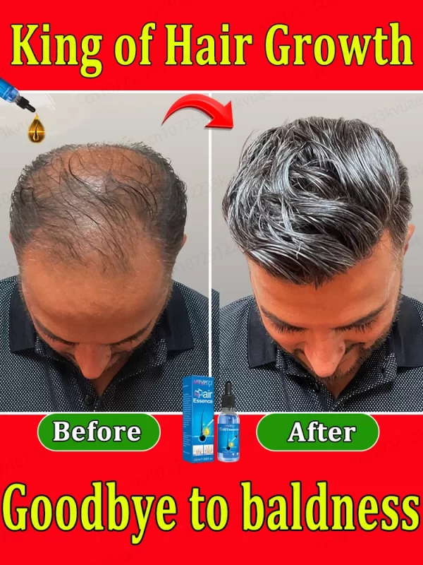 Hair loss savior. Repair hairline. Say goodbye to baldness and hair loss