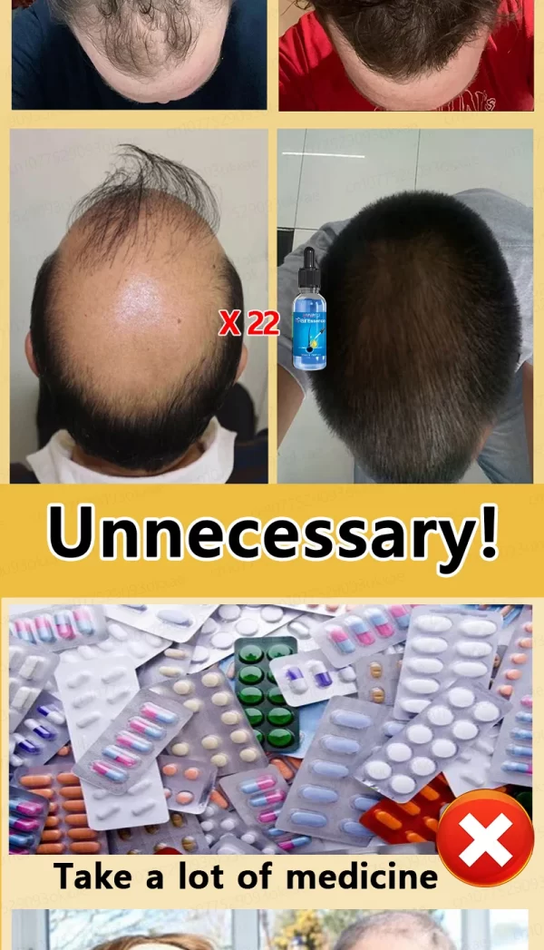 Hair loss savior. Repair hairline. Say goodbye to baldness and hair loss - Image 22