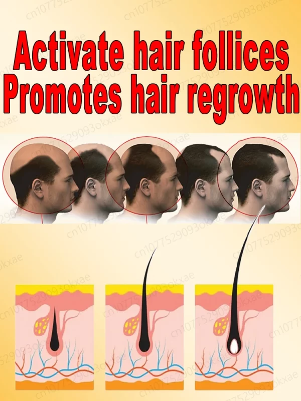 Hair loss savior. Repair hairline. Say goodbye to baldness and hair loss - Image 6