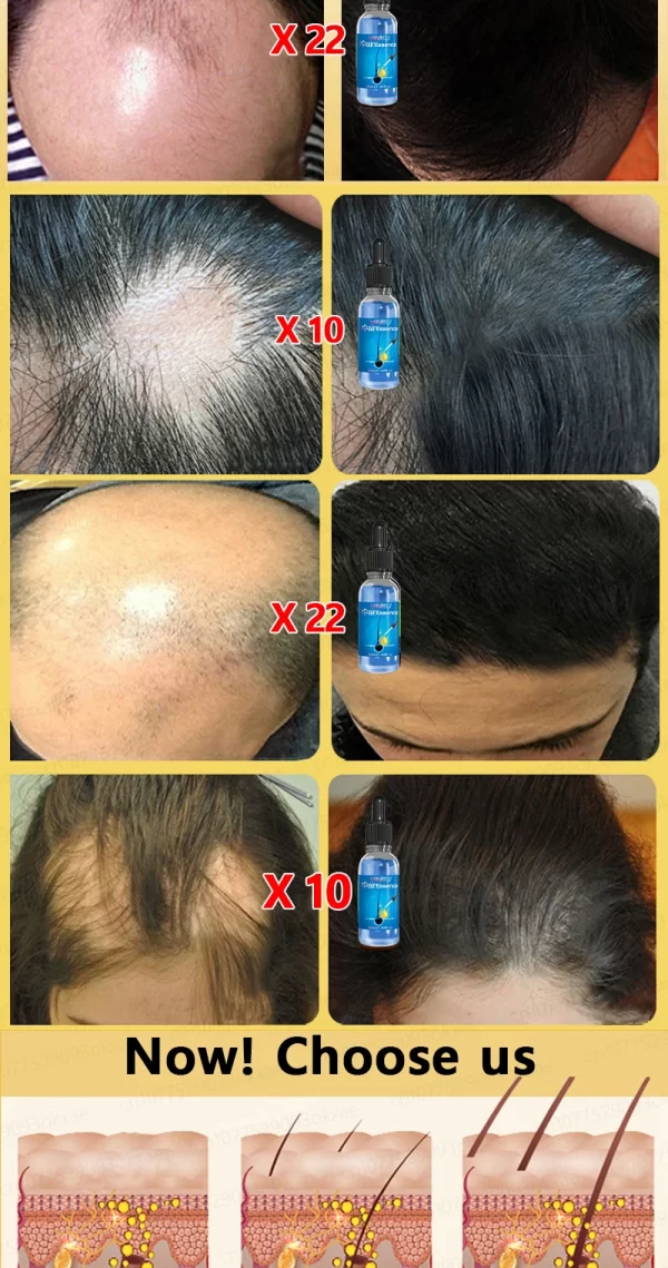 Hair loss savior. Repair hairline. Say goodbye to baldness and hair loss - Image 26